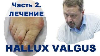 Косточки - hallux valgus. Мастер-класс. Часть 2. Лечение. Андрей Найдек