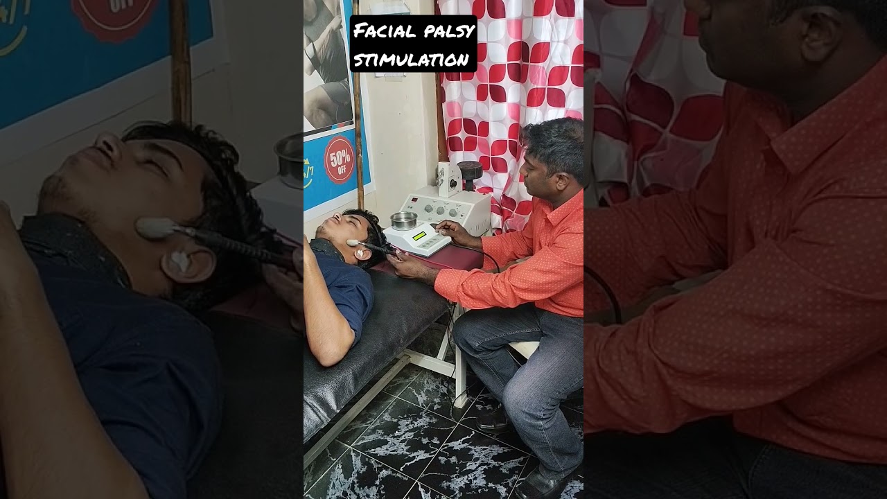 facial palsy stimulation⚕️