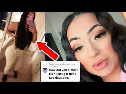 IG Model Cries Out For Help Once Her BBL Causes Her Butt Cheek TO DO THIS!