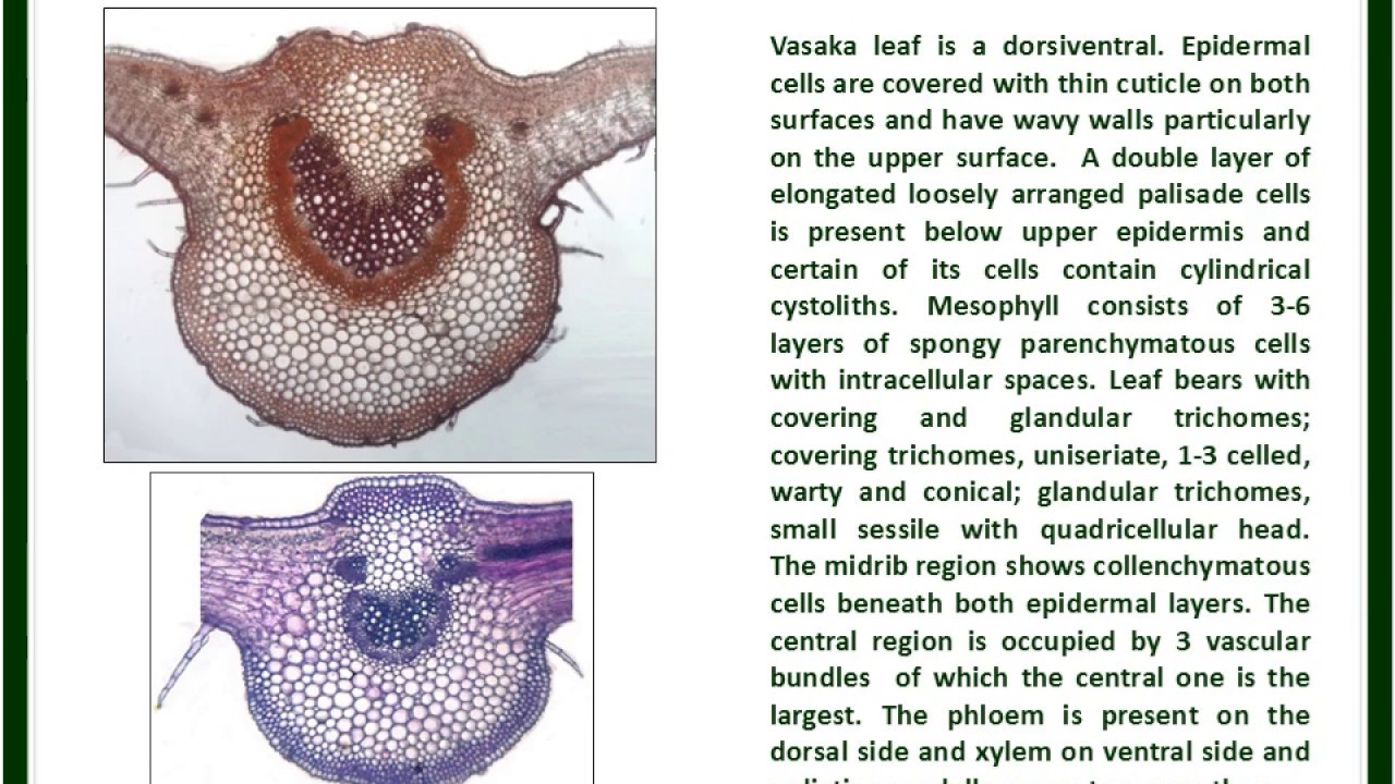 Vasaka Leaf Microscopy K S Laddha ICT YouTube Vasaka Leaf Microscopy K S Laddha ICT YouTube