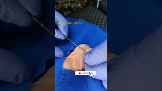 Download Lagu 🔴 PIERCING PENIANO - FRENUM PIERCING 🔴 #shorts MP3