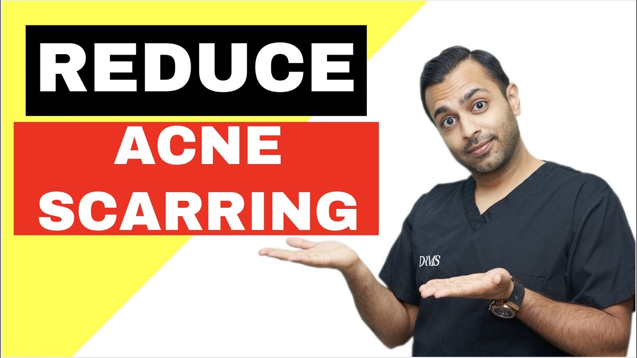 ACNE SCARRING REDUCTION What Is The Punch & Float Method? DrMediSpa