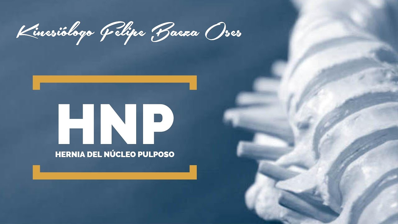 Hernia del núcleo pulposo camera iphone 8 plus apk