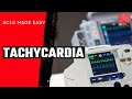 Acls tachycardia algorithm