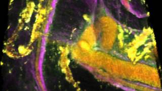 Blood, Heat, and Tumors - 2014 Image Award Winner