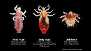 Epidemic Typhus, Epidemic Relapsing Fever, Trench Fever, Pediculosis Vagabonds Disease