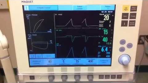 Maquet Servo-i Ventilator Graphics Scenario 1