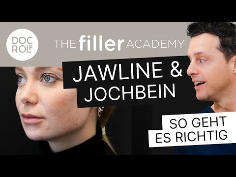 Unterspritzungstechnik JAWLINE und JOCHBEIN FILLER – TFA by doc.rolf