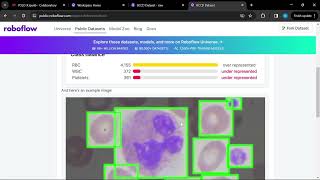 Downloading the BCCD Dataset from Roboflow #python #coding #objectdetection