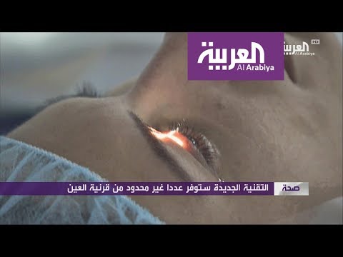 إنجاز علمي أول قرنية ثلاثية الأبعاد