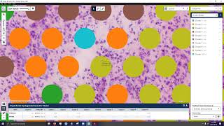 Discussion of Spatial Transcriptomics in QuPath
