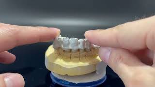 ARUM 5X-300Pro [PEEK TELESCOPIC] screenshot 5