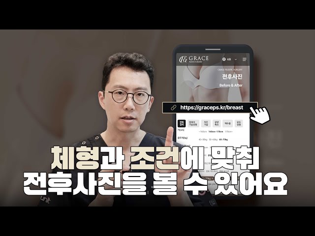 가슴성형, 진짜 내 체형과 비슷한 전후가 궁금하다면?