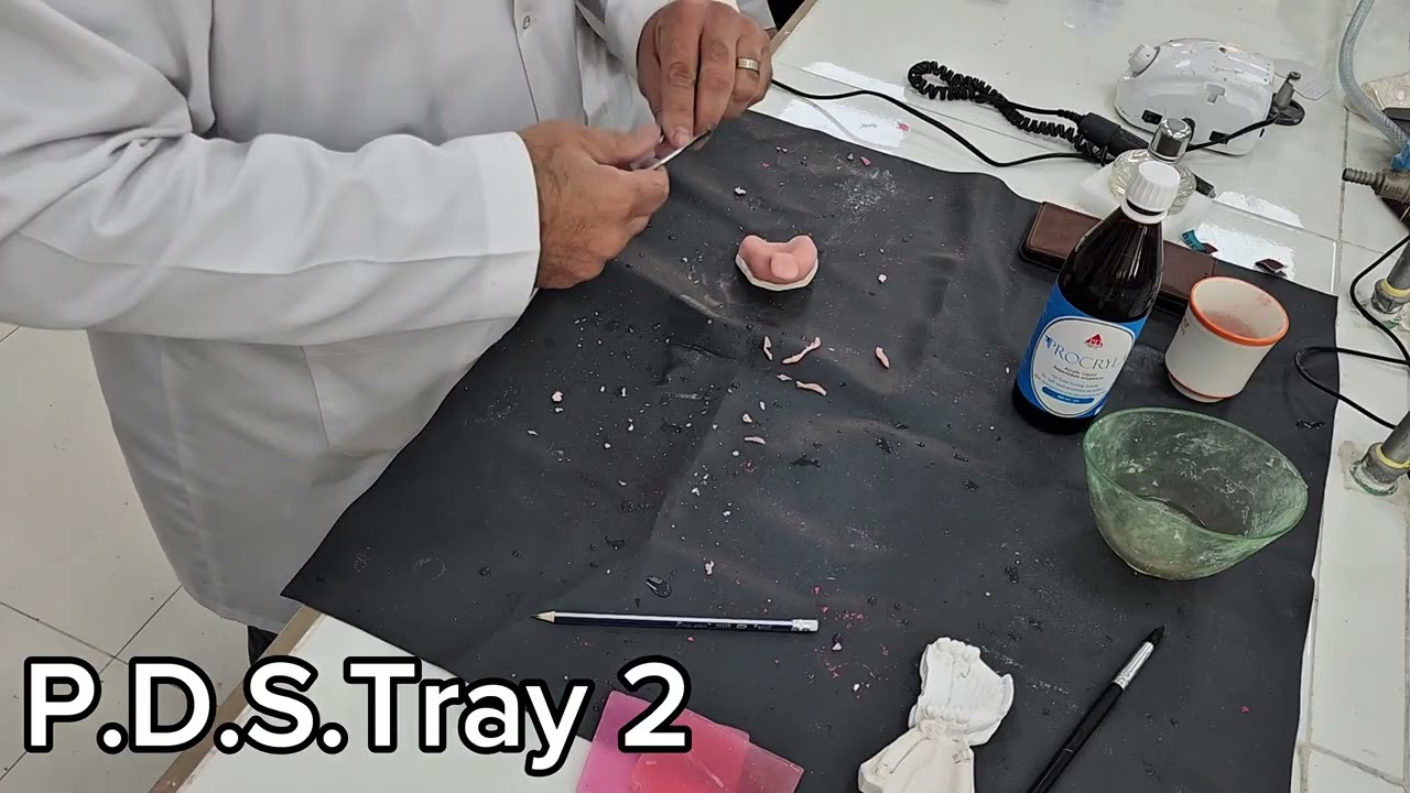Partial Denture Special Tray 2 (Tutorial)