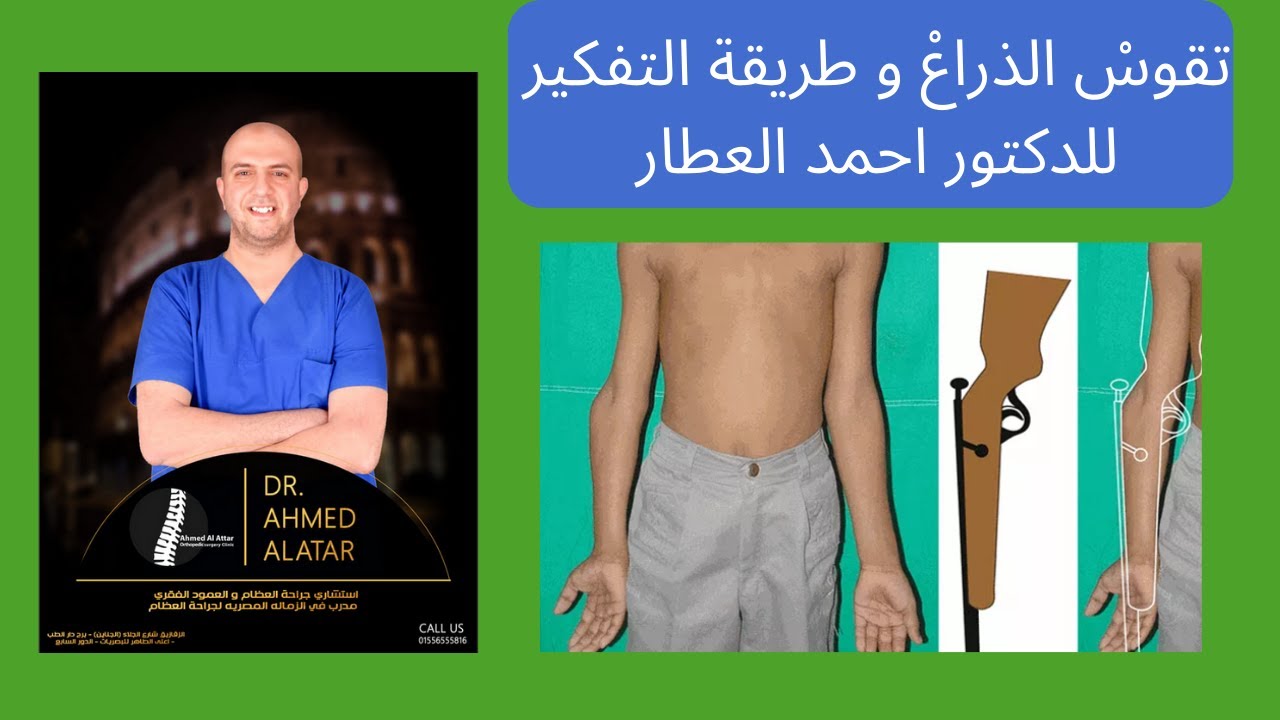 تقوسْ الذراعْ للدكتور احمد العطار
