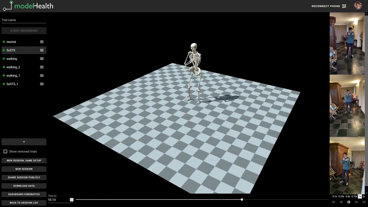 Model Health Overview