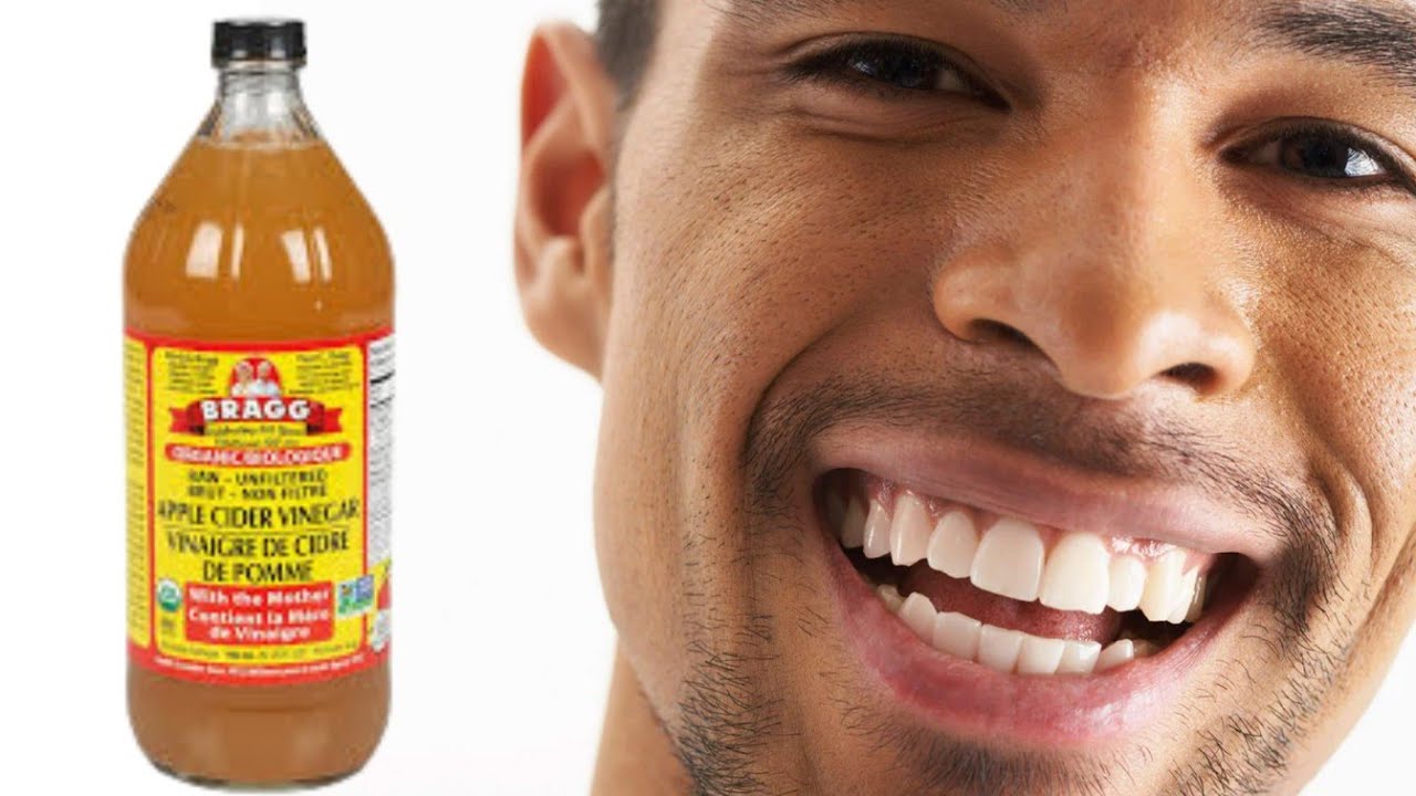 How To Use Apple Cider VInegar For Teeth Whitening YouTube