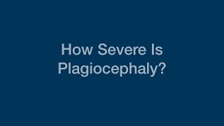 How Severe Is Plagiocephaly?