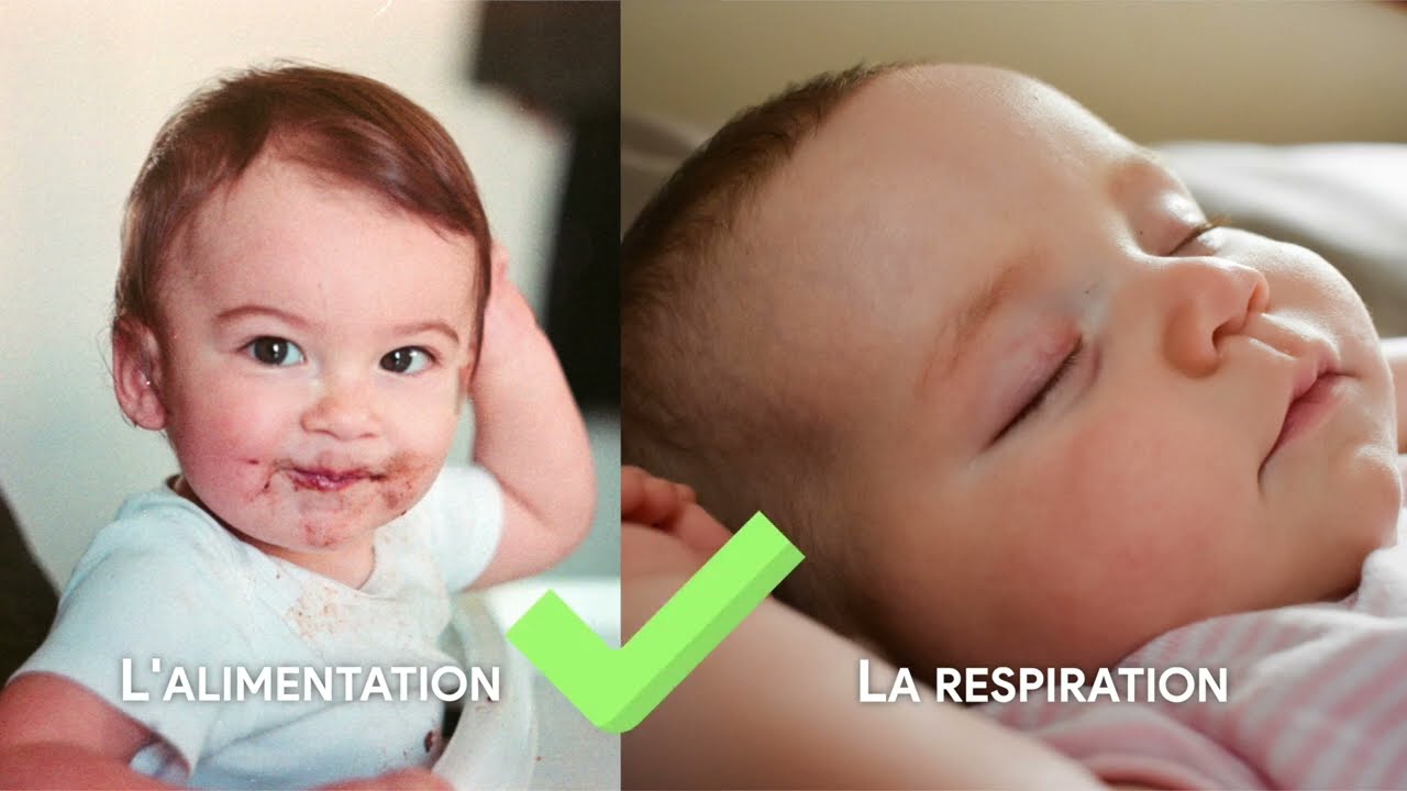 1/4 - Mon enfant est né avec une fente faciale. Qu'est-ce que c'est ?