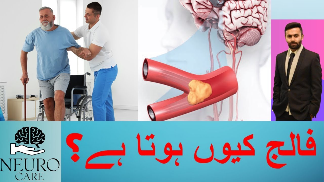 Ischemic Stroke simply Explained!! | Stroke Prevention | Neuro Care