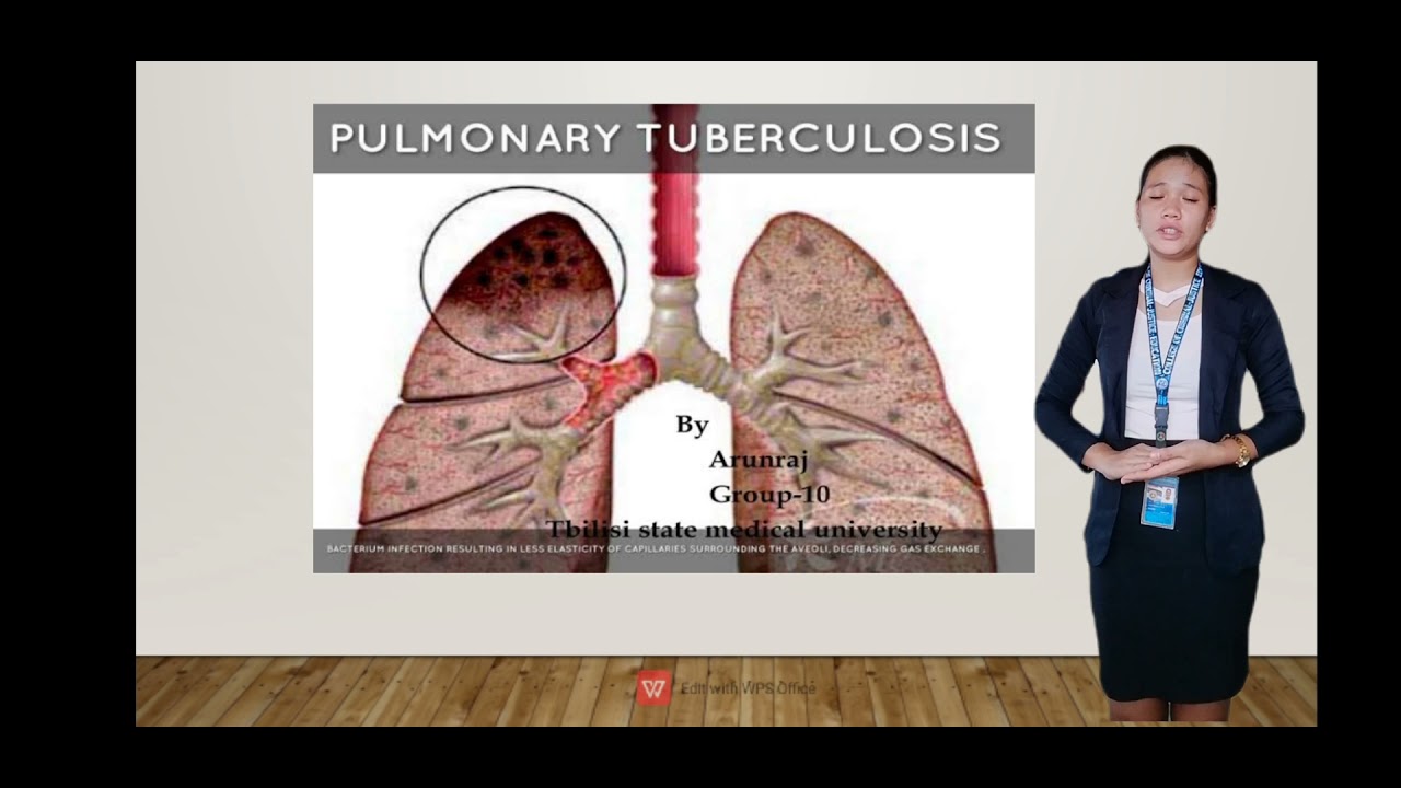 Global view on prison administration