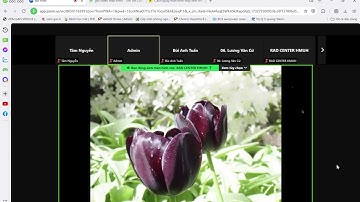 Chẩn đoán hình ảnh hệ tiết niệu - U bàng quang - Trường đh Y Hà Nội