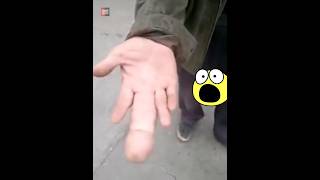 Why This Man Has Big Finger |😲😲| #shorts