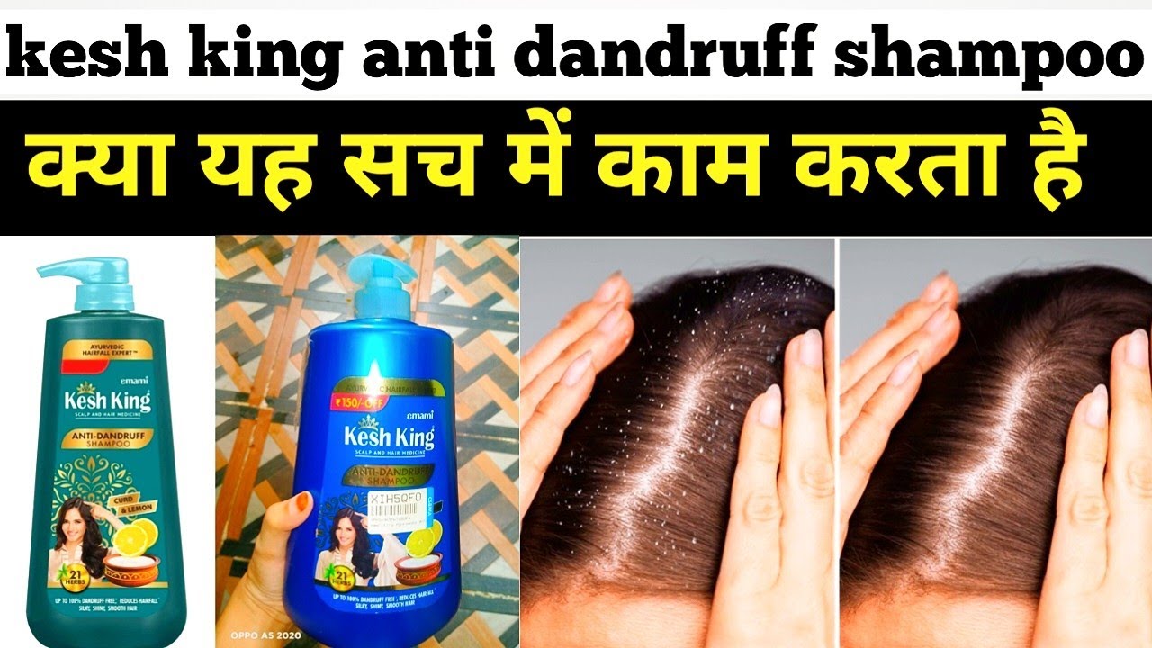 kesh king anti dandruff shampoo review | kesh king anti dandruff shampoo 