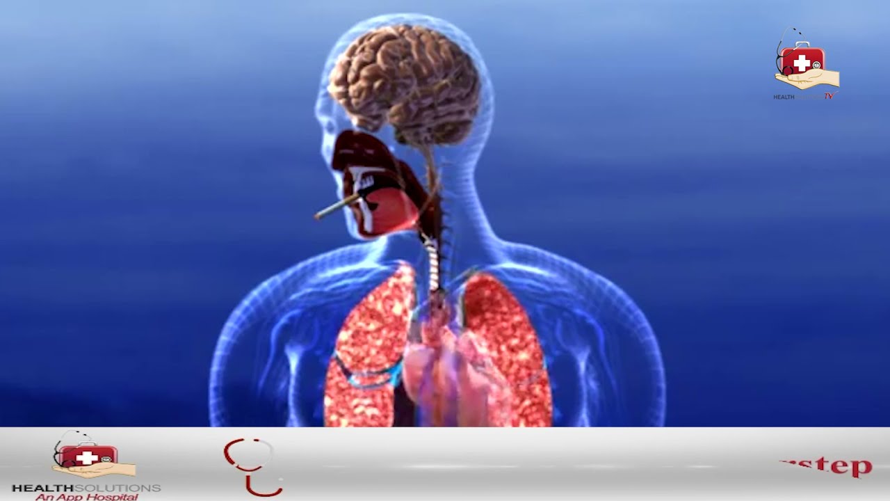 Smoking side effect II Report II HealthSolution Tv II HealthSolutions App