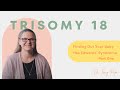 Trisomy 18 | Finding Out Your Baby Has Edwards' Syndrome