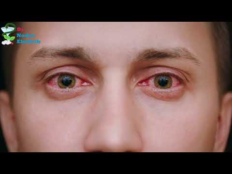 اليكم ارخص وافضل القطرات المرطبة لعلاج جفاف العين و احمرار وحساسية العين و احتقان العين وبديل الدموع