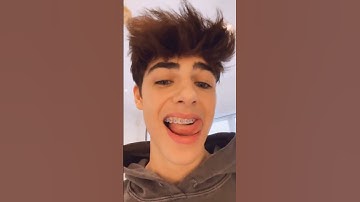 Kyle Thomas 💙 MY MUM IS FUMINGGGGG #diybraces #kylethomas #shorts