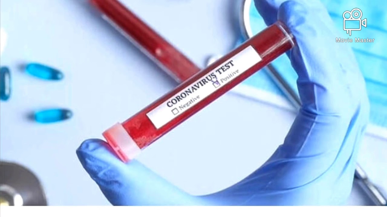 The BEST COVID-19 SONG ( Medical Frontliners) Save Lives