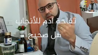 الكل يقول علي تفاحة ادم وصفة  للحمل