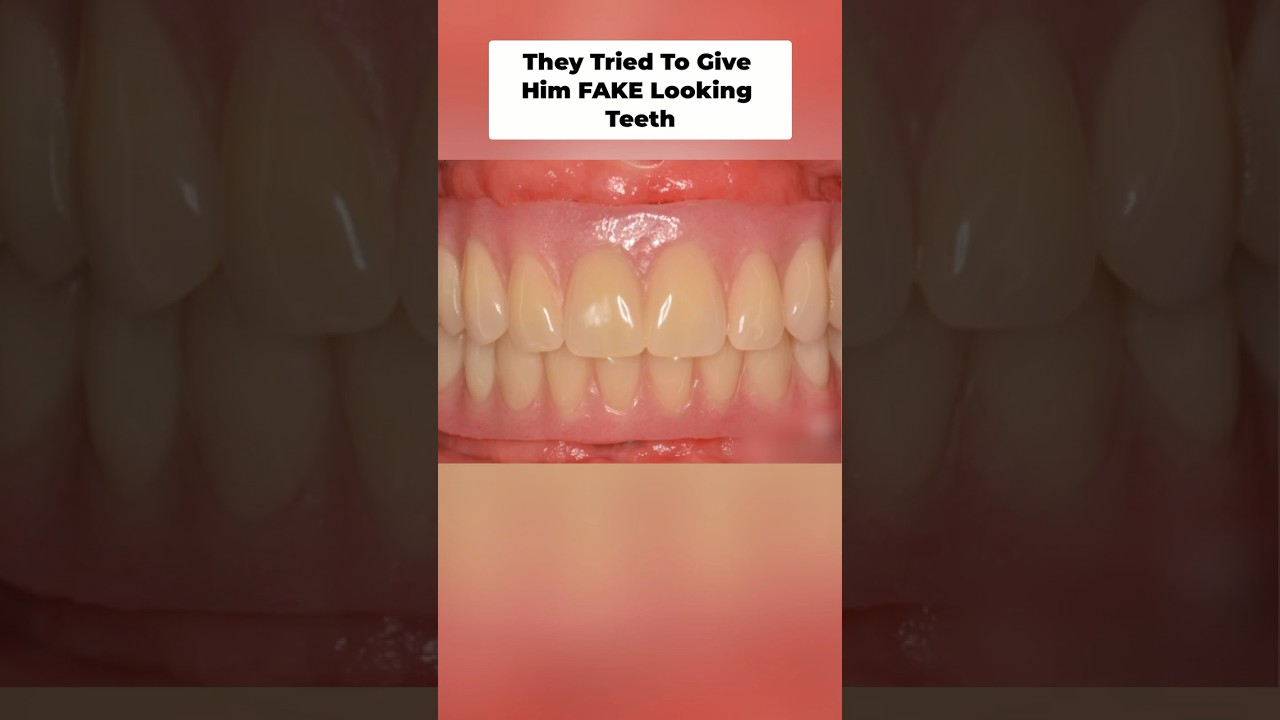 Be Careful of "One-Size-Fits-All" Teeth...