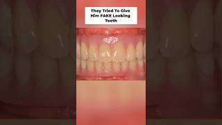 Be Careful of One-Size-Fits-All Teeth...