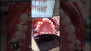 REAL or A.I.??? #smiledesigndental #Milandentist