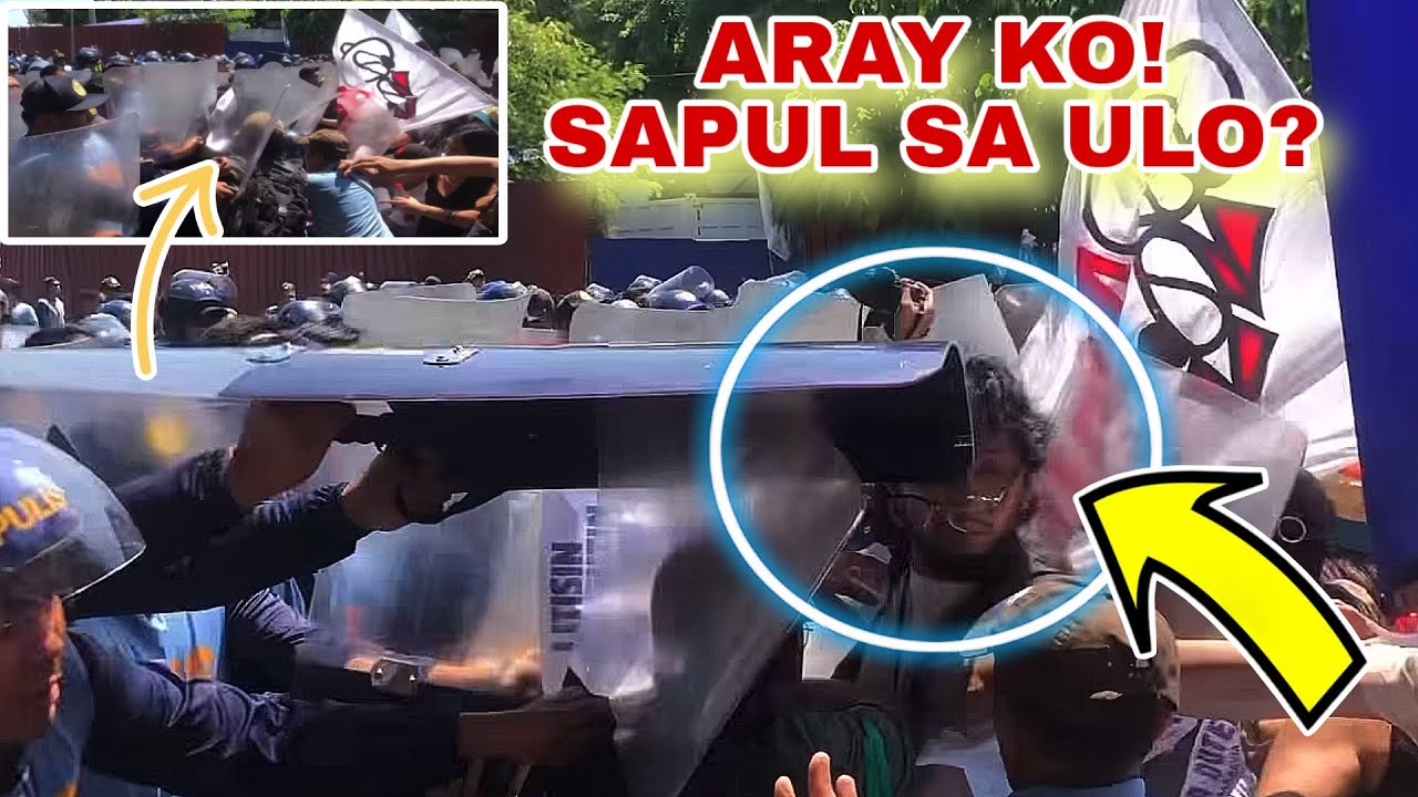 Sumugod sa senado Sapul sa ulo ang rallyistang makakaliwa?