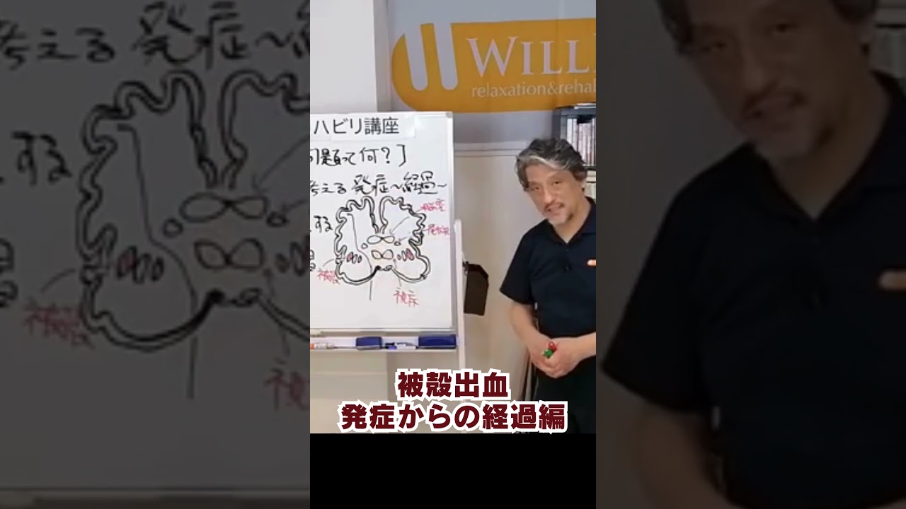 被殻出血 発症からの経過 #脳卒中リハビリ #脳卒中片麻痺 #自費リハ #理学療法士 #作業療法士 #被殻出血 #視床出血 #脳梗塞リハビリ #shorts