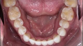 Boschetti Dental PC - Trusted Cosmetic & Emergency Dentist | Serving Revere & Beyond