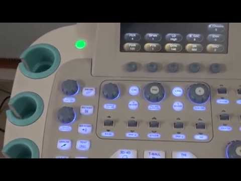Ультразвукова система SIUI Apogee 3500, відео 1