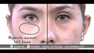 Iklan Skinelle Di Tv9