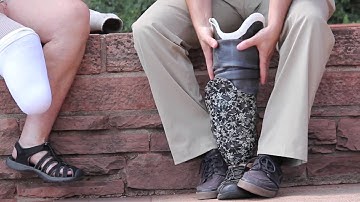 Prosthesis Sock Ply Management