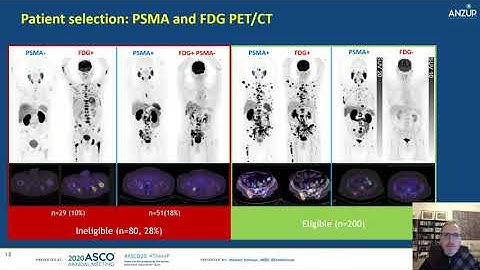 ANZSNM ArtNet Talk by Professor Michael Hofman #ProsTIC