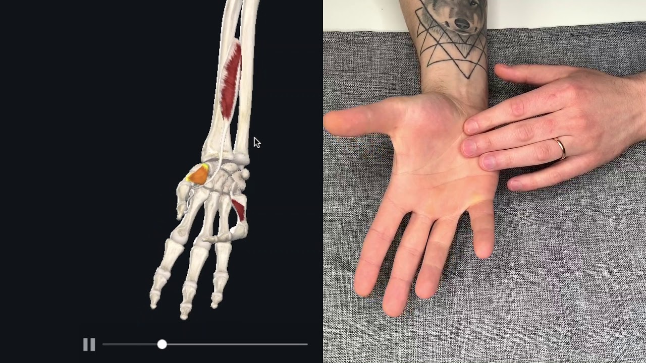 artroza tretman falanga ruke