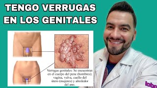 Tengo Verrugas En Los Genitales Condilomas Acuminados Verrugas Genitales Dr David Campos