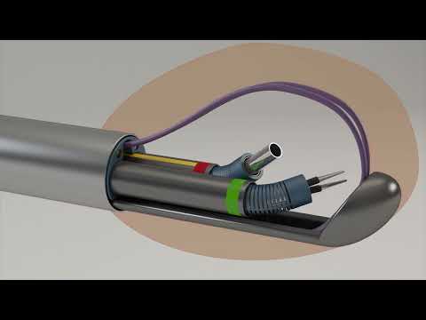 Tamar Robotics - החברה שמחוללת מהפכה בעולם הנוירוכירורגיה! - video from ToGeTher