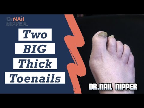 वीडियो: Toenail Trims - इस Vet के अस्तित्व का बैन