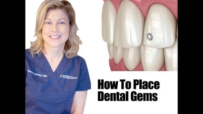 Lesson 4. Tooth gems decoration patterns. Teeth gems kit. Tooth gem  training kit. Teeth gems kit 