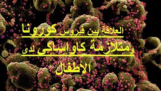 متلازمة كاواساكي المرتبطة بفيروس كورونا التي تصيب الأطفال بعد اصابتهم ب covid19